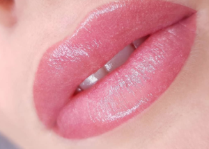Dermatopigmentatie Frozen lips