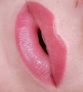 Dermatopigmentatie fronzen lips