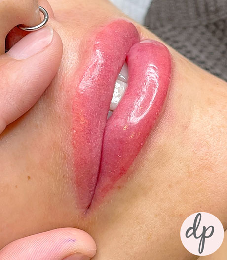 Dermatopigmentatie lippigmentatie baby lips